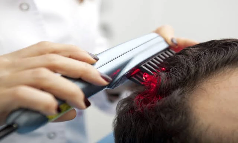 Low-Level Laser Therapy Complementing Personalized Hair Restoration Treatment Plans