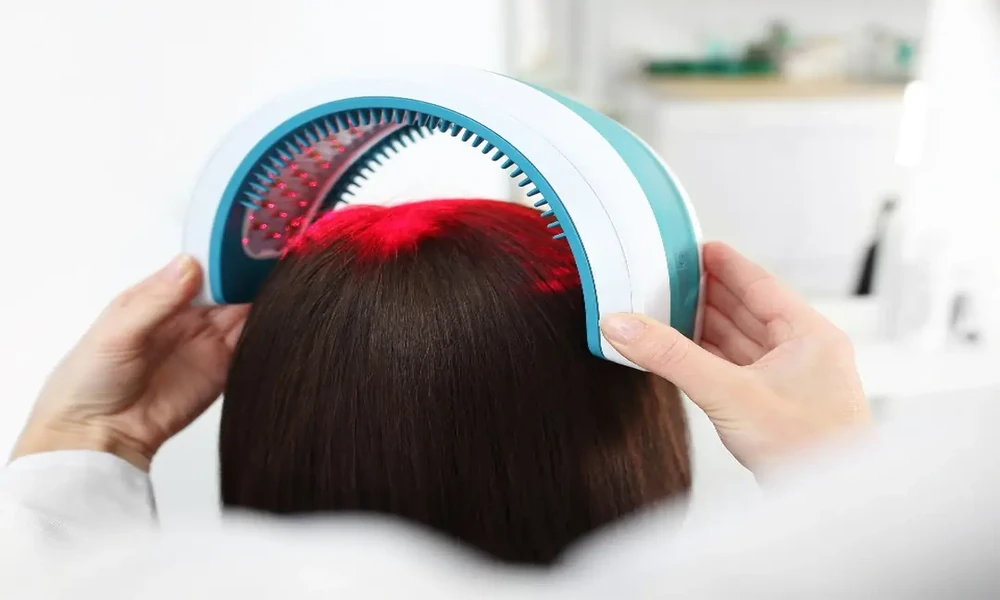 Where Low-Level Laser Therapy Fits Into A Hair Loss Treatment Plan